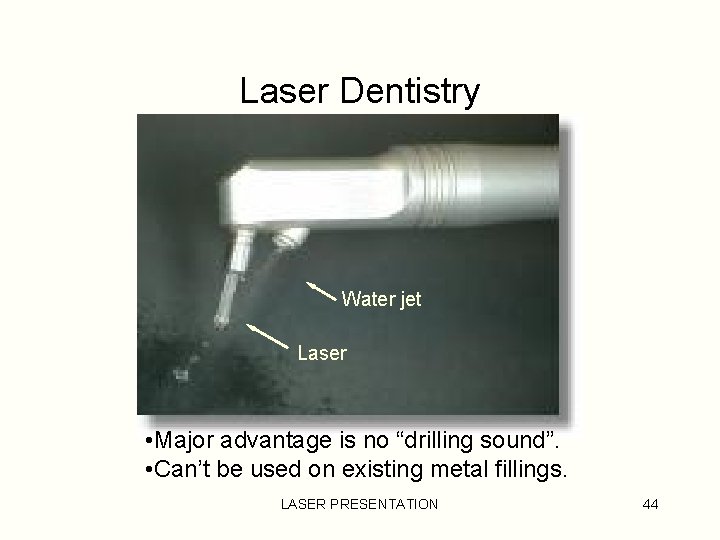 Laser Dentistry Water jet Laser • Major advantage is no “drilling sound”. • Can’t