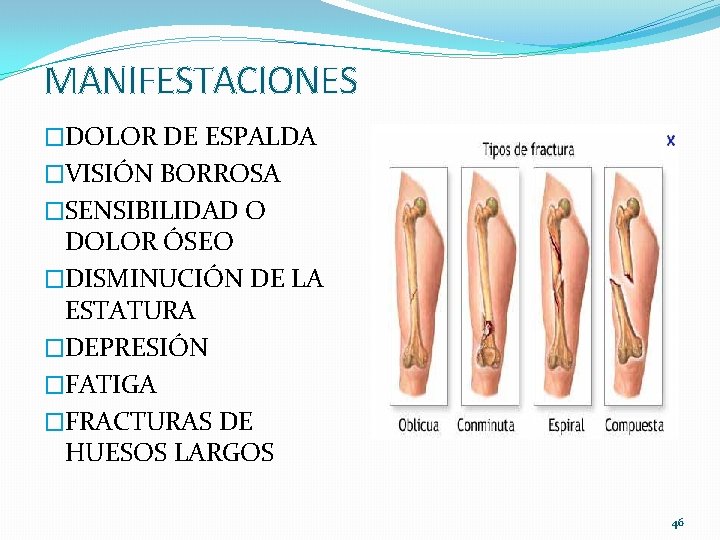 MANIFESTACIONES �DOLOR DE ESPALDA �VISIÓN BORROSA �SENSIBILIDAD O DOLOR ÓSEO �DISMINUCIÓN DE LA ESTATURA