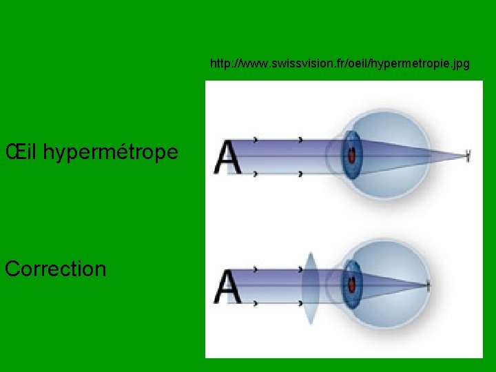 http: //www. swissvision. fr/oeil/hypermetropie. jpg Œil hypermétrope Correction 