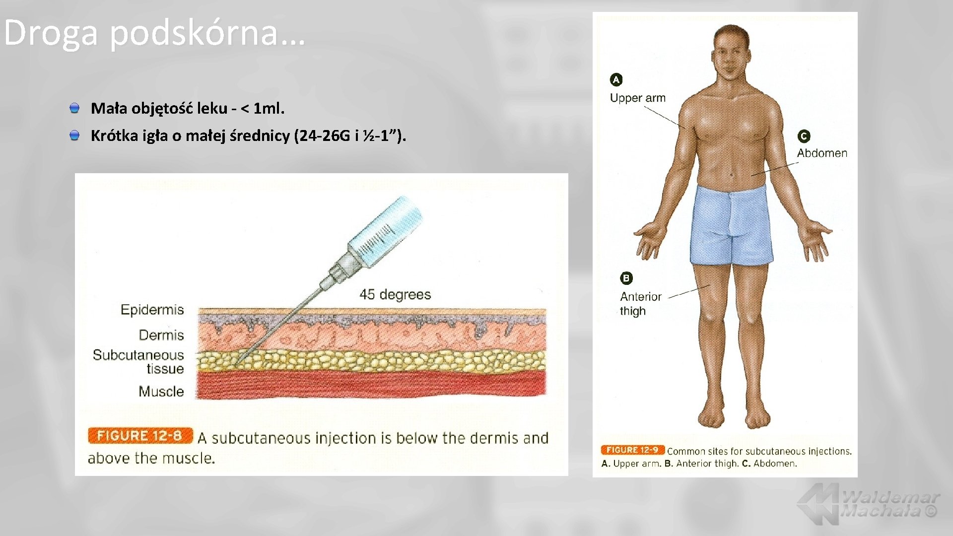 Droga podskórna… Mała objętość leku - < 1 ml. Krótka igła o małej średnicy
