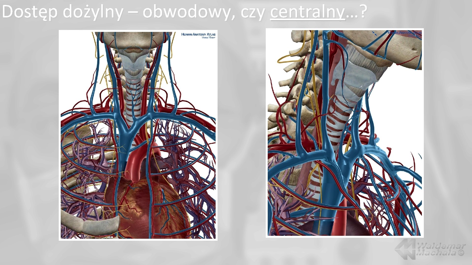 Dostęp dożylny – obwodowy, czy centralny…? 