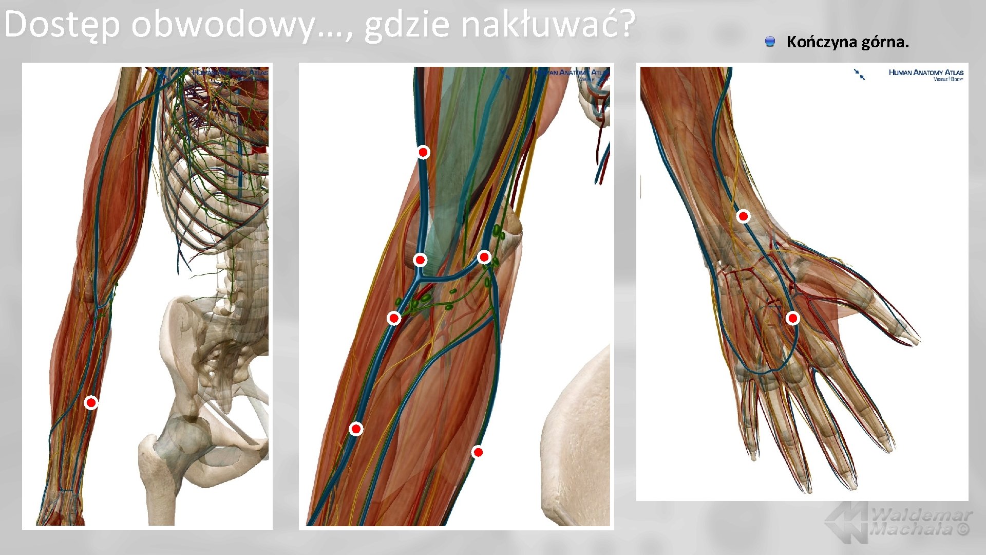 Dostęp obwodowy…, gdzie nakłuwać? Kończyna górna. 