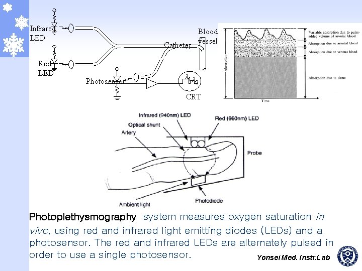 Infrared LED Red LED Blood vessel Catheter Photosensor 1 2 CRT Photoplethysmography system measures