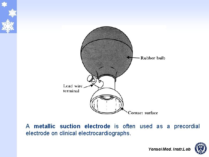 A metallic suction electrode is often used as a precordial electrode on clinical electrocardiographs.