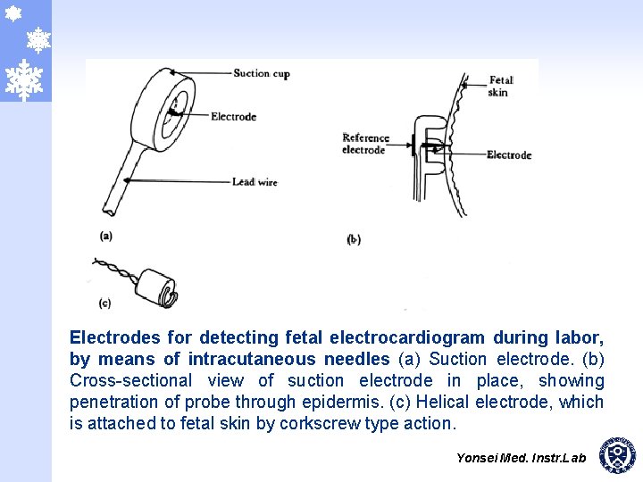 Electrodes for detecting fetal electrocardiogram during labor, by means of intracutaneous needles (a) Suction