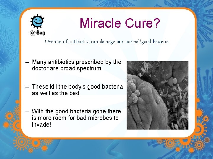 Miracle Cure? Overuse of antibiotics can damage our normal/good bacteria. – Many antibiotics prescribed