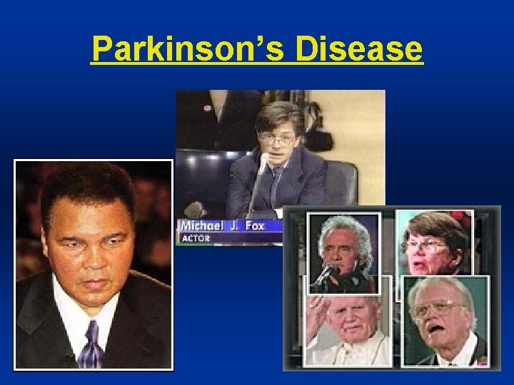 Parkinson’s Disease 