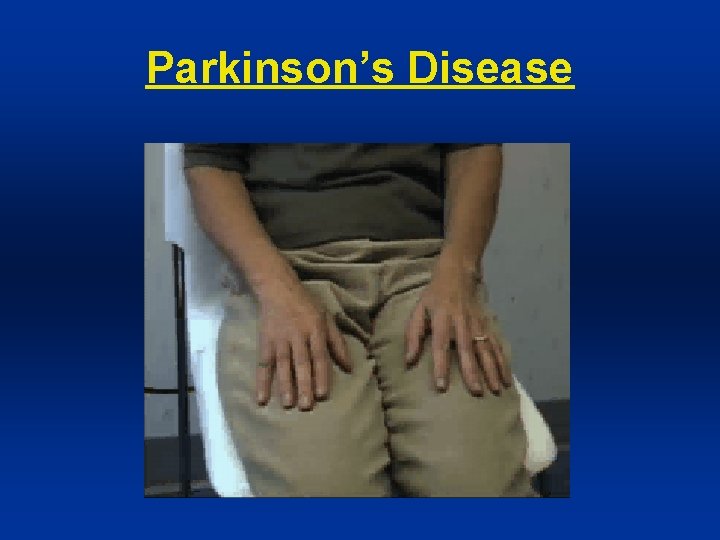 Parkinson’s Disease 