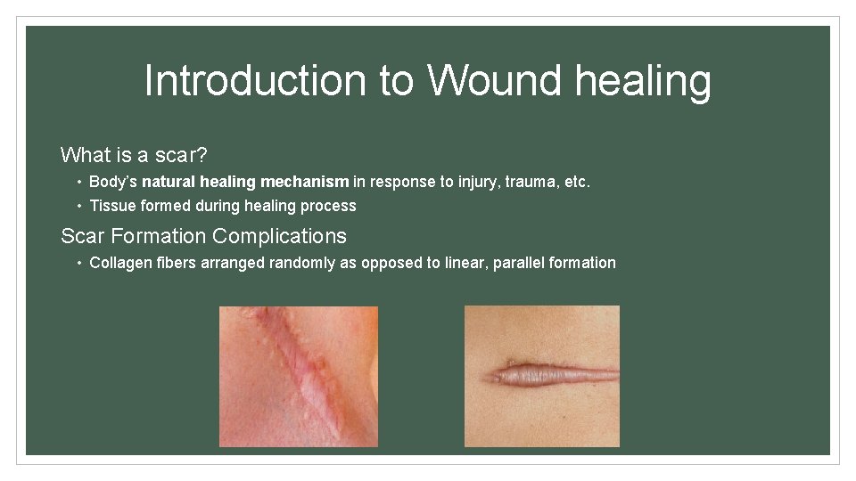 Introduction to Wound healing What is a scar? • Body’s natural healing mechanism in