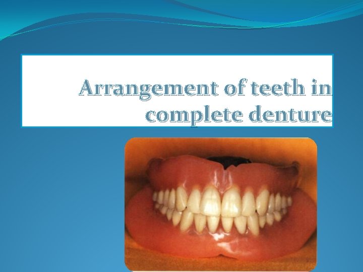 Arrangement of teeth in complete denture 