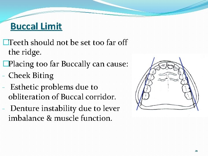 Buccal Limit �Teeth should not be set too far off the ridge. �Placing too