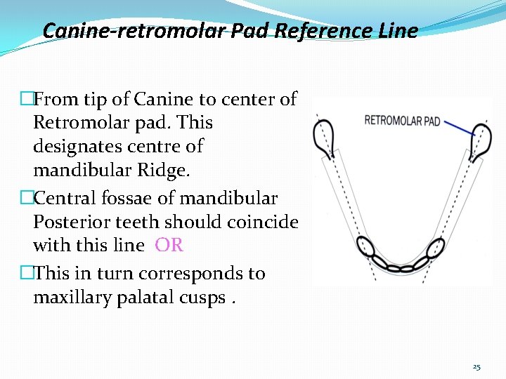 Canine-retromolar Pad Reference Line �From tip of Canine to center of Retromolar pad. This