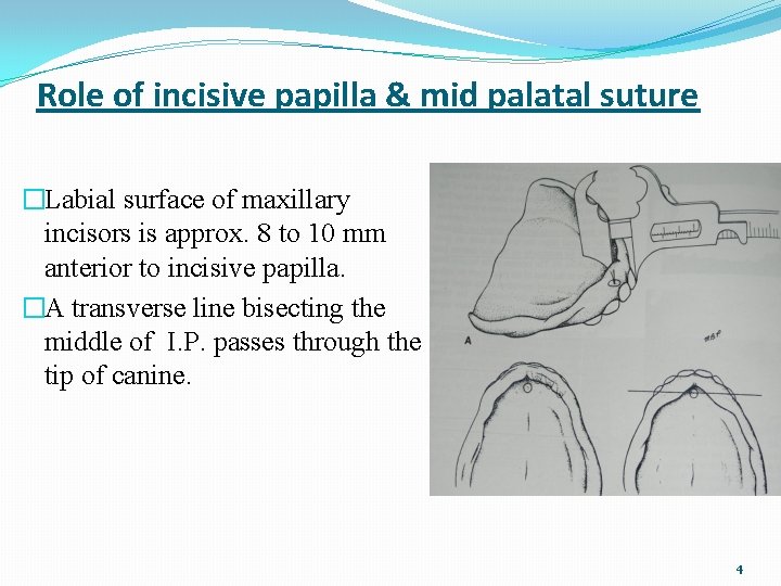 Role of incisive papilla & mid palatal suture �Labial surface of maxillary incisors is