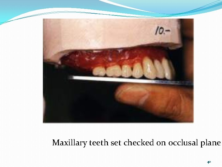 Maxillary teeth set checked on occlusal plane 40 