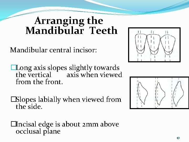 Arranging the Mandibular Teeth Mandibular central incisor: �Long axis slopes slightly towards the vertical