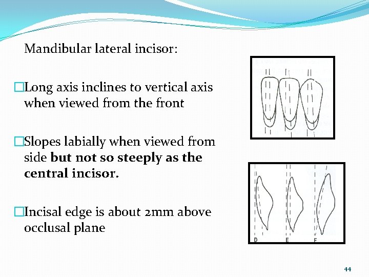 Mandibular lateral incisor: �Long axis inclines to vertical axis when viewed from the front