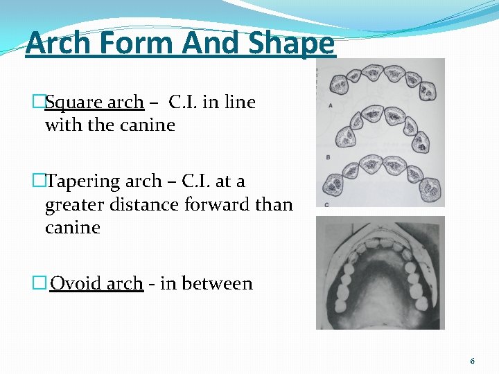 Arch Form And Shape �Square arch – C. I. in line with the canine