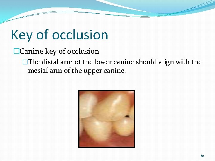 Key of occlusion �Canine key of occlusion �The distal arm of the lower canine