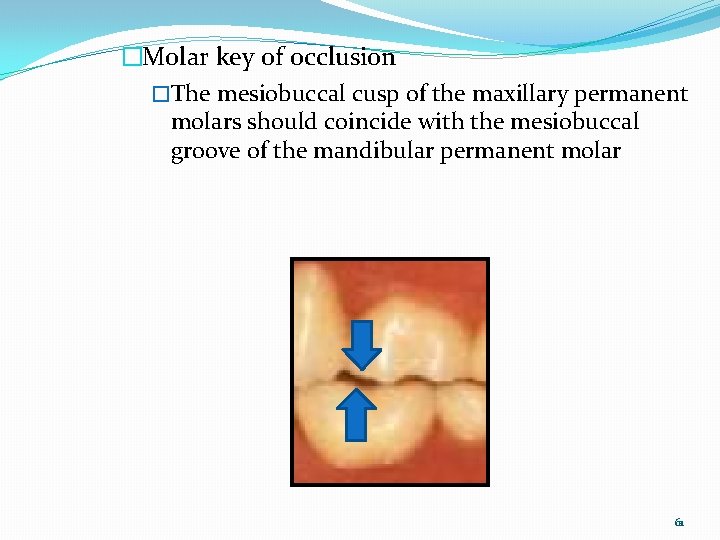 �Molar key of occlusion �The mesiobuccal cusp of the maxillary permanent molars should coincide