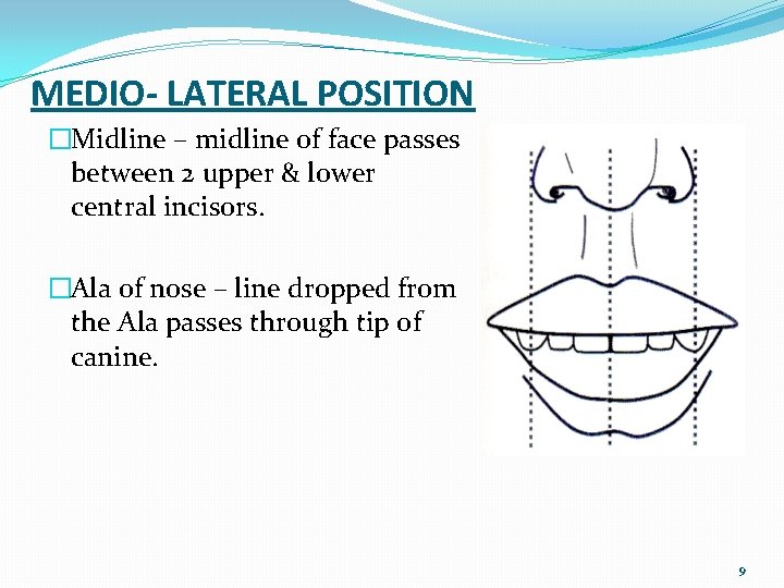 MEDIO- LATERAL POSITION �Midline – midline of face passes between 2 upper & lower