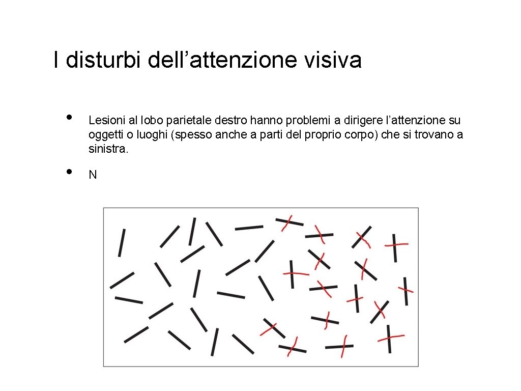 I disturbi dell’attenzione visiva • • Lesioni al lobo parietale destro hanno problemi a