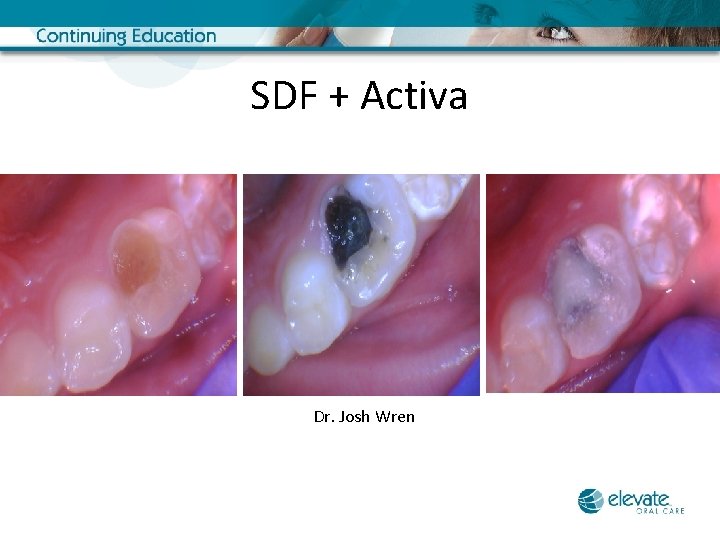 SDF + Activa Dr. Josh Wren 