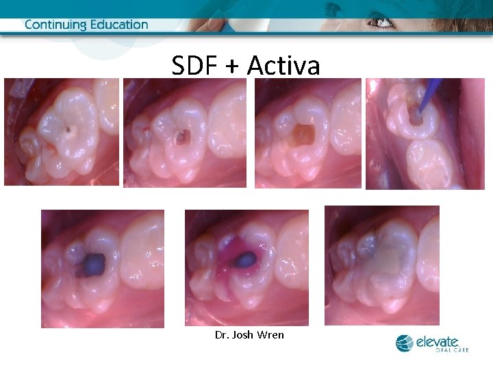 SDF + Activa Dr. Josh Wren 