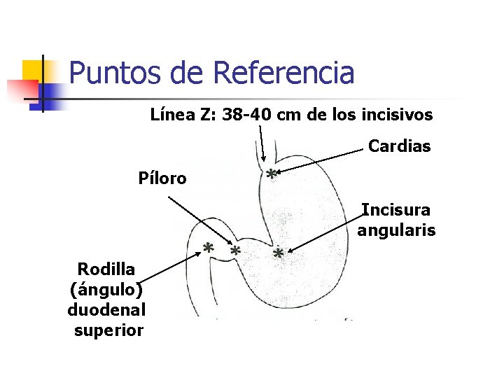 Puntos de Referencia Línea Z: 38 -40 cm de los incisivos Cardias Píloro Incisura