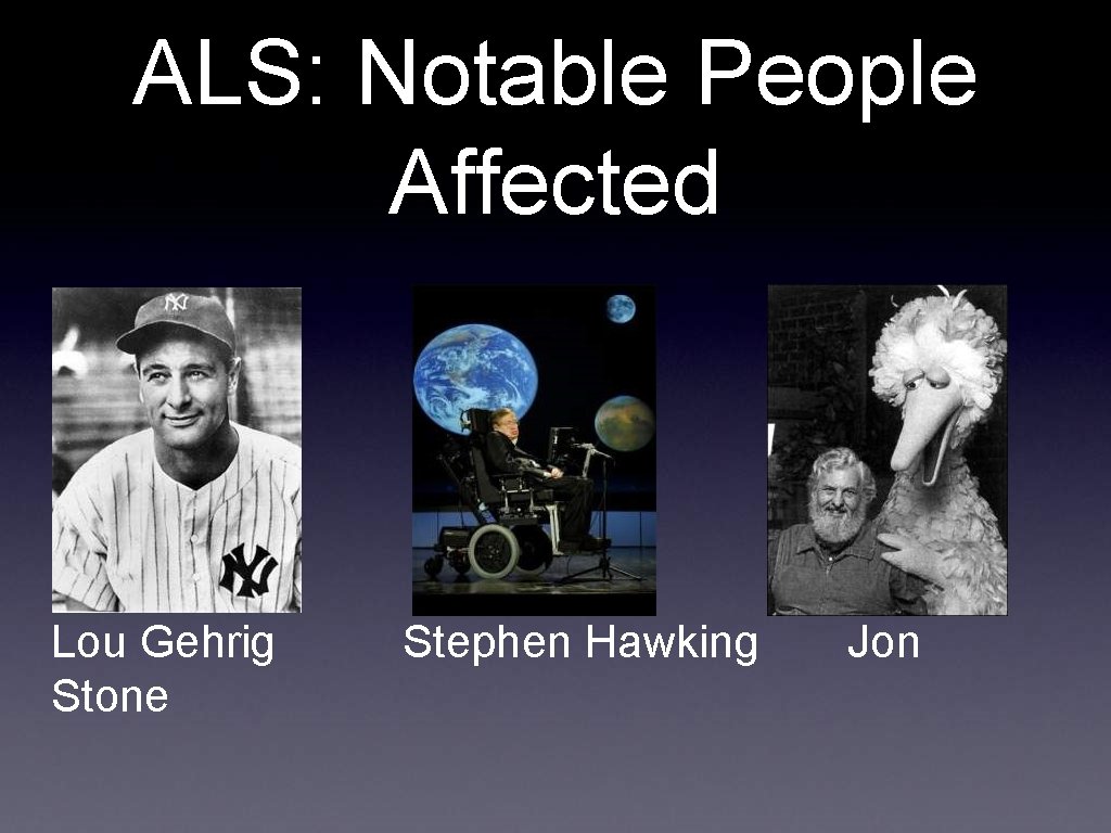 ALS: Notable People Affected Lou Gehrig Stone Stephen Hawking Jon 