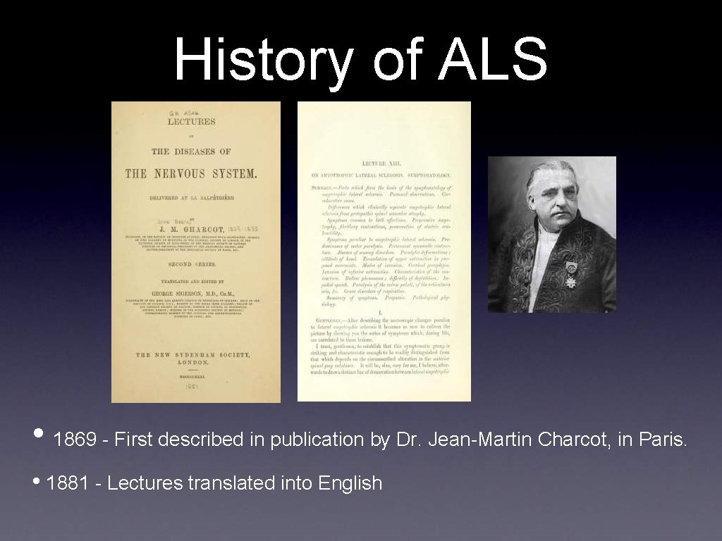 History of ALS • 1869 - First described in publication by Dr. Jean-Martin Charcot,