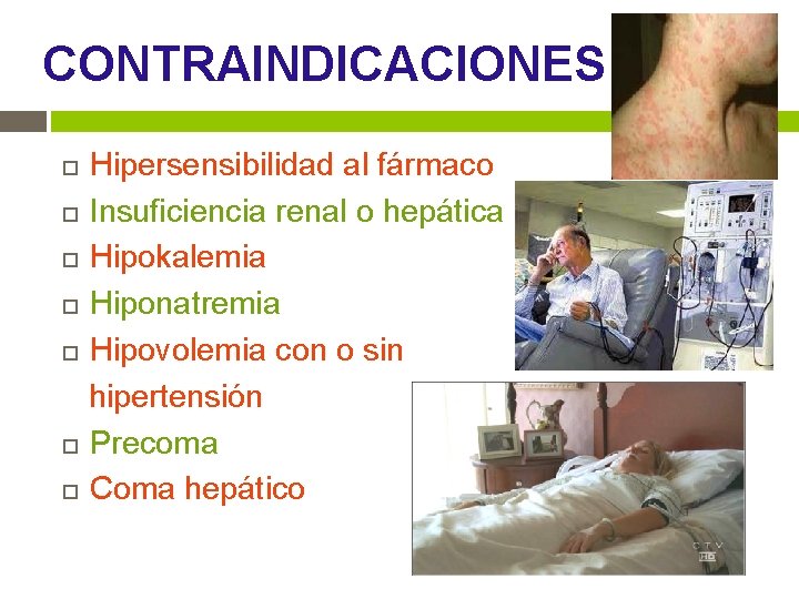 CONTRAINDICACIONES Hipersensibilidad al fármaco Insuficiencia renal o hepática Hipokalemia Hiponatremia Hipovolemia con o sin CONTRAINDICACIONES Hipersensibilidad al fármaco Insuficiencia renal o hepática Hipokalemia Hiponatremia Hipovolemia con o sin