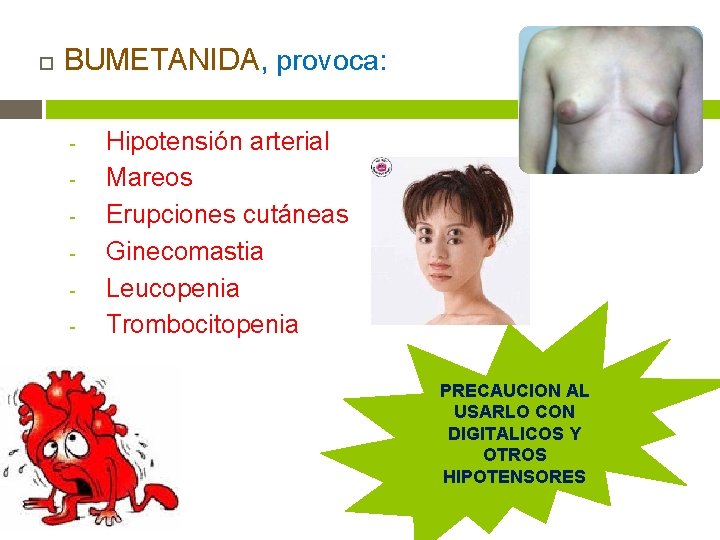 BUMETANIDA, provoca: - Hipotensión arterial Mareos Erupciones cutáneas Ginecomastia Leucopenia Trombocitopenia PRECAUCION AL BUMETANIDA, provoca: - Hipotensión arterial Mareos Erupciones cutáneas Ginecomastia Leucopenia Trombocitopenia PRECAUCION AL