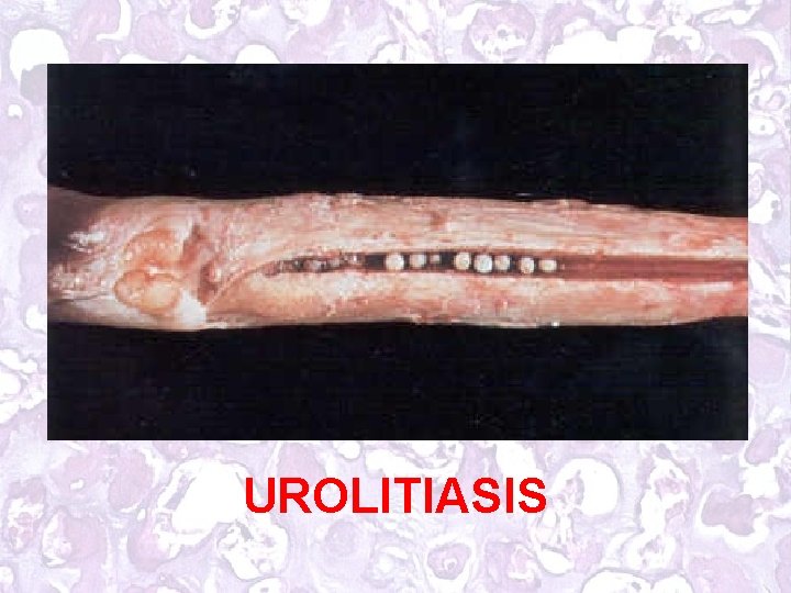 UROLITIASIS 