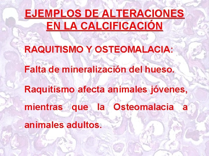 EJEMPLOS DE ALTERACIONES EN LA CALCIFICACIÓN RAQUITISMO Y OSTEOMALACIA: OSTEOMALACIA Falta de mineralización del