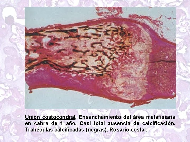 Unión costocondral. Ensanchamiento del área metafisiaria en cabra de 1 año. Casi total ausencia