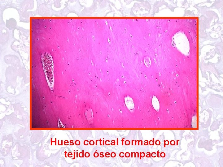 Hueso cortical formado por tejido óseo compacto 