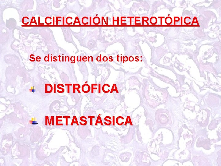 CALCIFICACIÓN HETEROTÓPICA Se distinguen dos tipos: DISTRÓFICA METASTÁSICA 