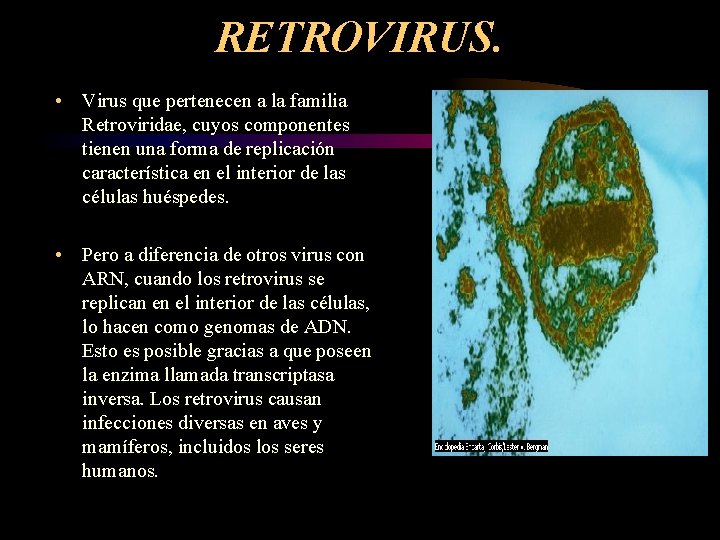 RETROVIRUS. • Virus que pertenecen a la familia Retroviridae, cuyos componentes tienen una forma RETROVIRUS. • Virus que pertenecen a la familia Retroviridae, cuyos componentes tienen una forma