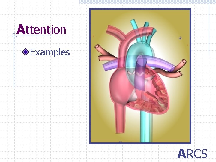 Attention Examples ARCS 