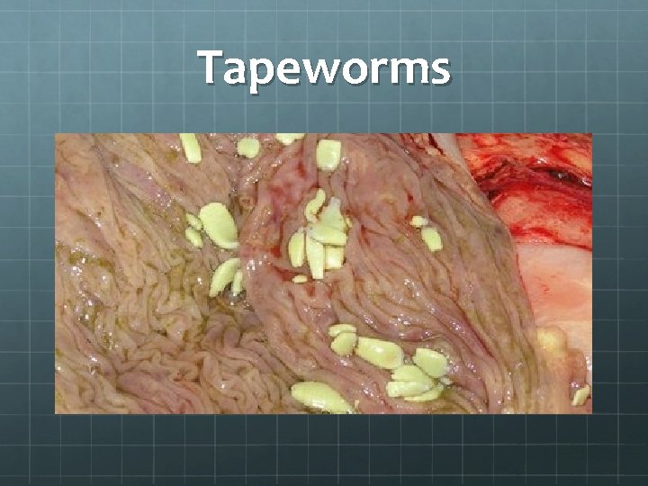 Tapeworms 