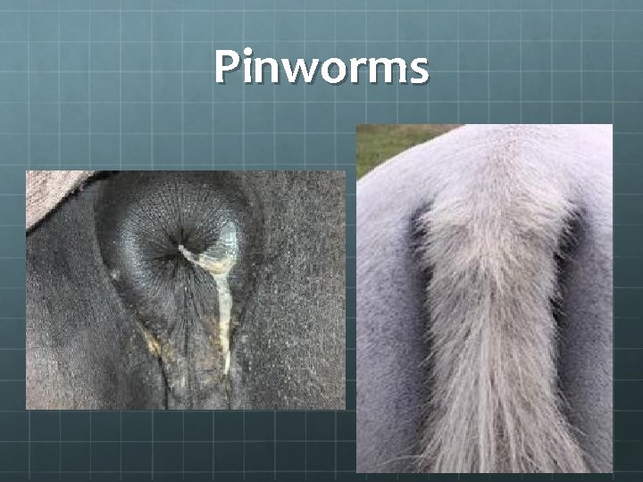 Pinworms 