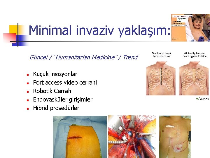 Minimal invaziv yaklaşım: Güncel / “Humanitarian Medicine” / Trend n n n Küçük insizyonlar