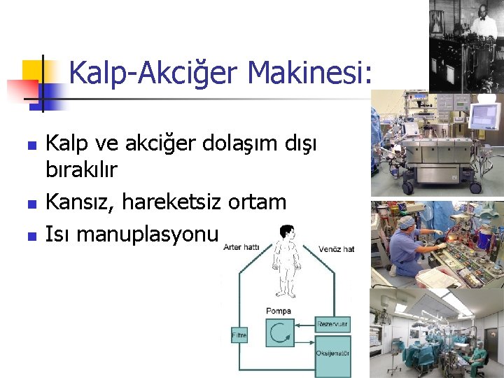 Kalp-Akciğer Makinesi: n n n Kalp ve akciğer dolaşım dışı bırakılır Kansız, hareketsiz ortam