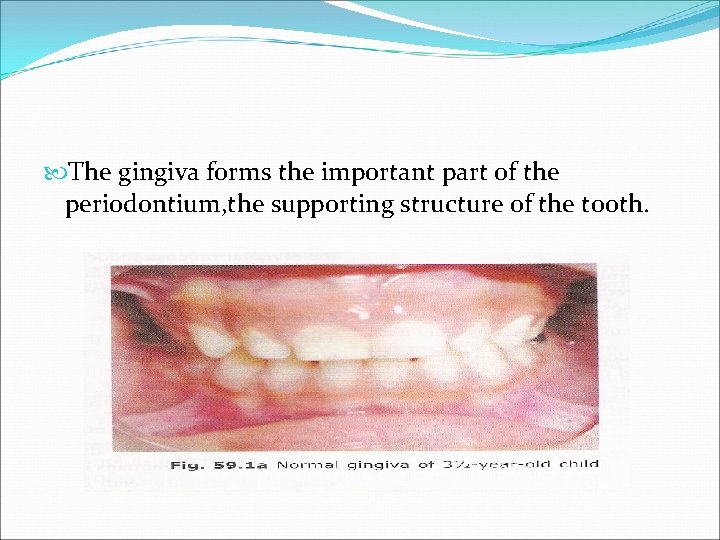  The gingiva forms the important part of the periodontium, the supporting structure of