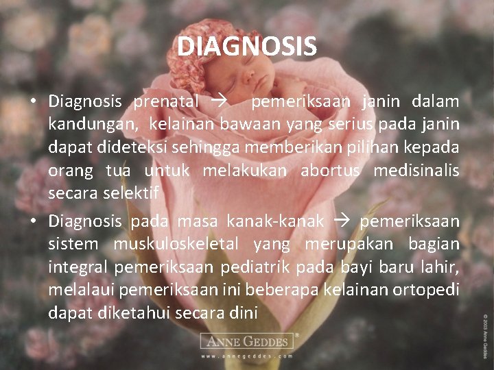 DIAGNOSIS • Diagnosis prenatal pemeriksaan janin dalam kandungan, kelainan bawaan yang serius pada janin