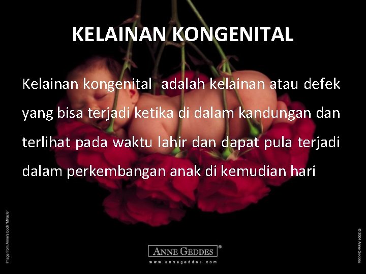 KELAINAN KONGENITAL Kelainan kongenital adalah kelainan atau defek yang bisa terjadi ketika di dalam