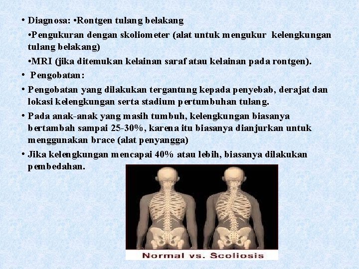  • Diagnosa: • Rontgen tulang belakang • Pengukuran dengan skoliometer (alat untuk mengukur