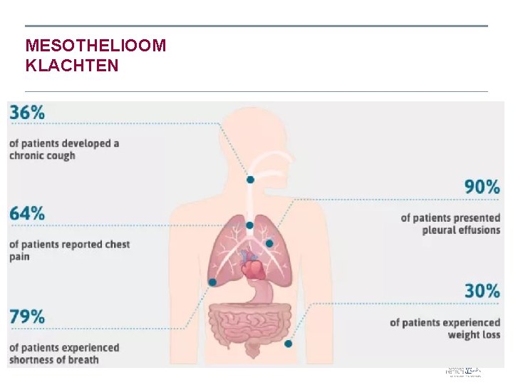 MESOTHELIOOM KLACHTEN • Symptomen: 