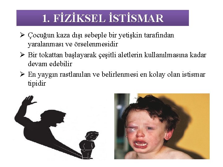 1. FİZİKSEL İSTİSMAR Ø Çocuğun kaza dışı sebeple bir yetişkin tarafından yaralanması ve örselenmesidir