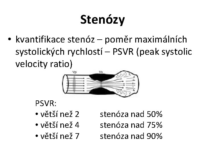 Stenózy • kvantifikace stenóz – poměr maximálních systolických rychlostí – PSVR (peak systolic velocity